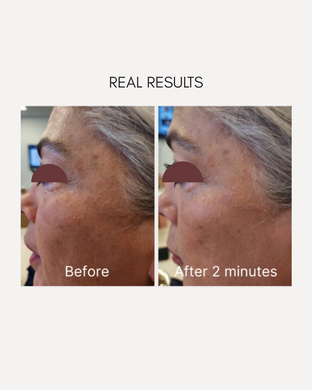 Blure Serum | Pore-Blurring & Anti-Aging Complex | Professional Stock Formula